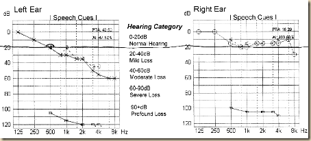 hearing